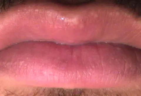 aphlabate (aph’la-bate), dir. Jean-Marc Superville Sovak - close-up on white man's lips